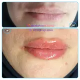کلینیک پوست زیبایی و لیزر دکتر مریم فرجی