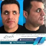 دکتر احمد ابراهیمی