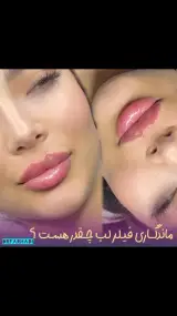 مطب زیبایی دکتر اشکان فرهادی