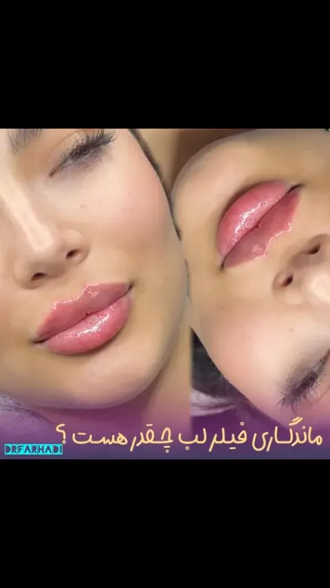 مطب زیبایی دکتر اشکان فرهادی