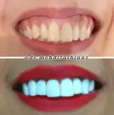 دندان پزشکی دکتر مهدی فتحی ناز