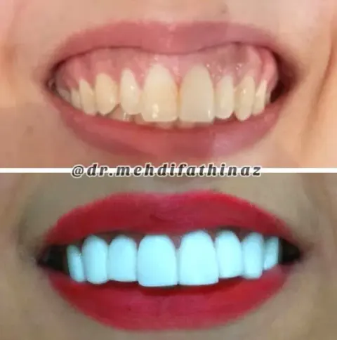 دندان پزشکی دکتر مهدی فتحی ناز