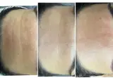 مشاوره پوست ومو (آترین بیوتی)
