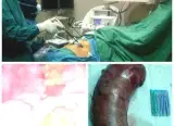 مطب دکتر هاشمی زاده فوق تخصص جراحی لاپاراسکوپی
