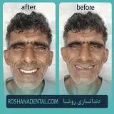 لابراتوار دندانسازی روشَنا در بندرعباس