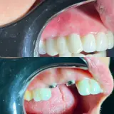 دندانپزشکی دکتر زکیه پورذکریا