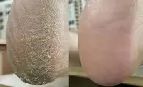خدمات لیفت مژه و ابرو