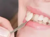 دندانپزشكي زيبايي دكترشجاعيفر