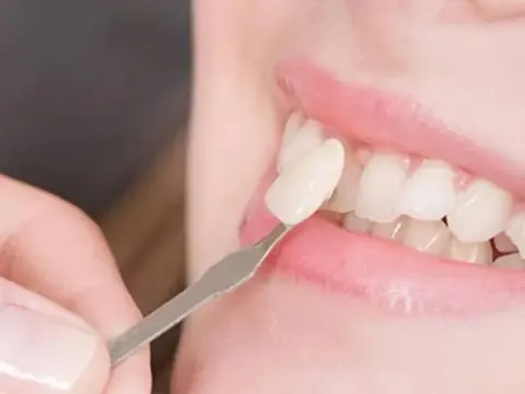 دندانپزشكي زيبايي دكترشجاعيفر