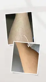 کلینیک پوست و مو زیبایی و لیزر هیوا