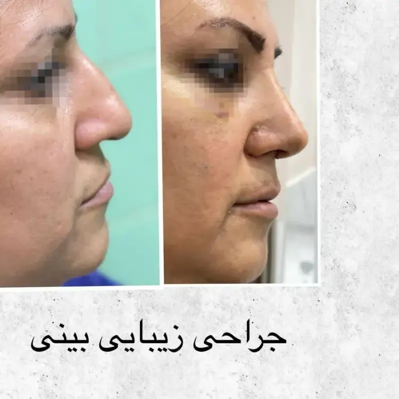 کلینیک زیبایی دکتر همایون زهتاب