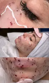 فیشیال آئورا -شبنم جلالی