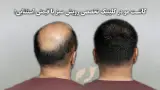 رویش سبز