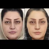 کلینیک زیبایی و لیزر سپیداسکین در تهران