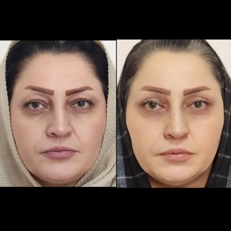کلینیک زیبایی و لیزر سپیداسکین در تهران