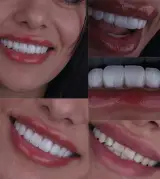 دندانپزشکی زیبایی دِنت لَند