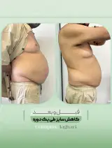 کلینیک زیبایی و لاغری سلین