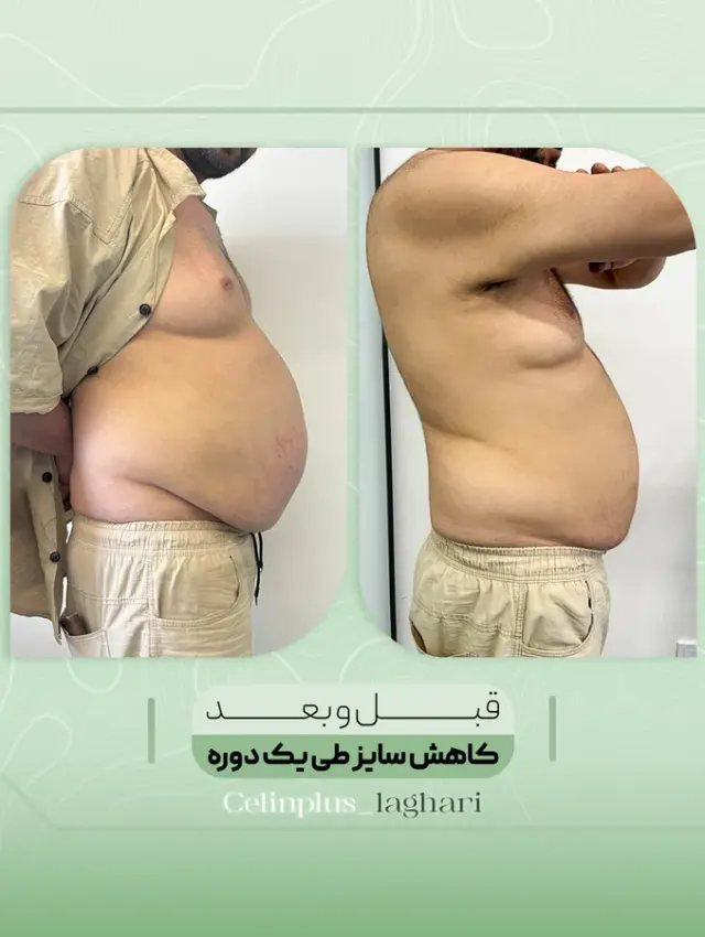 کلینیک زیبایی و لاغری سلین