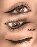 میکروبلیدینگ و فیبروز
