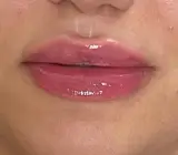 کلینیک زیبایی الناز همتی