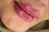 کلینیک زیبایی پوست و مو آرسام در بابلسر
