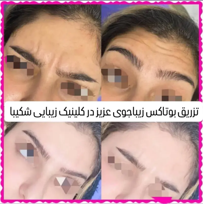 کلینیک زیبایی پوست نیایش