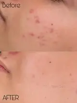 مرکز تخصصی پاکسازی پوست نیلو
