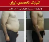 کلینیک لاغری روژینا نادری در اهواز