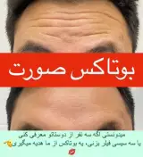 کلینیک تزریق ژل ستی در گرگان