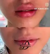 کلینیک زیبایی دکتر اسما ارجمندی در شرق تهران