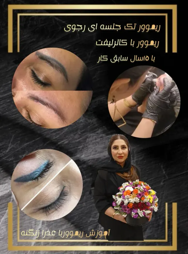 عذرا زنگنه ریموور تک جلسه ای