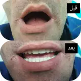 دندانسازی واعظی در مازندران