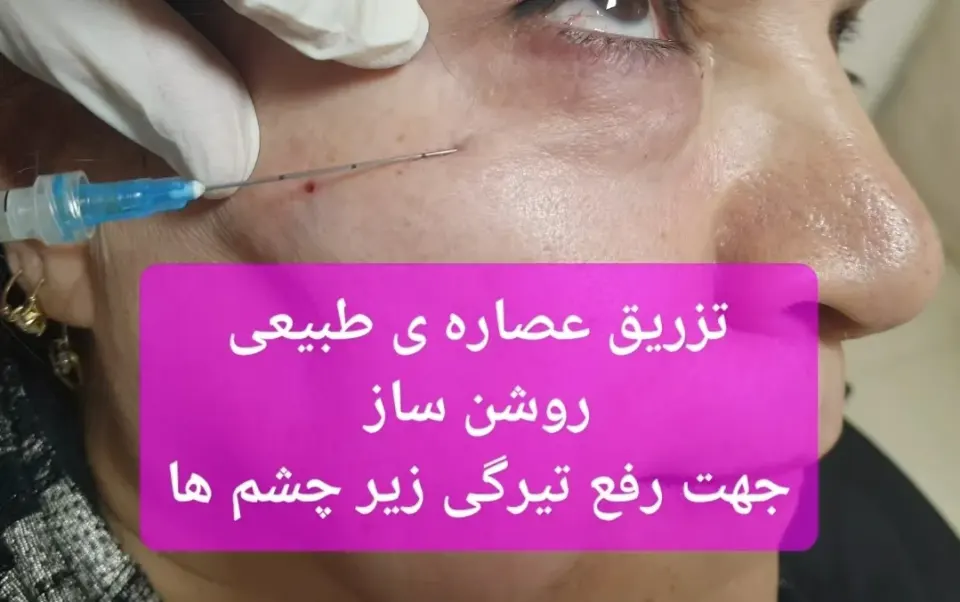کلینیک زیبایی پوست و مو حکیم