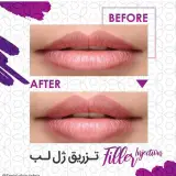کلینیک کاشت مو و زیبایی سپید
