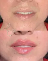 خدمات پوست بیتا