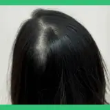 فردائم ،فر مهی