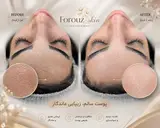 پاکسازی و فیشیال درمانی فروزان