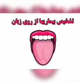 طب زبانشناسی حمزه پور