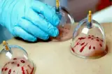 مرکز تخصصی طب سنتی و سوزنی رویال تبریز