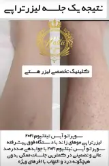 کلینیک تخصصی لیزر هستی در اهواز