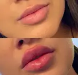 مطب پوست و مو زیبایی السا