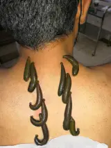 طب سنتی اوسینا
