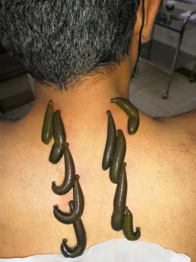 طب سنتی اوسینا