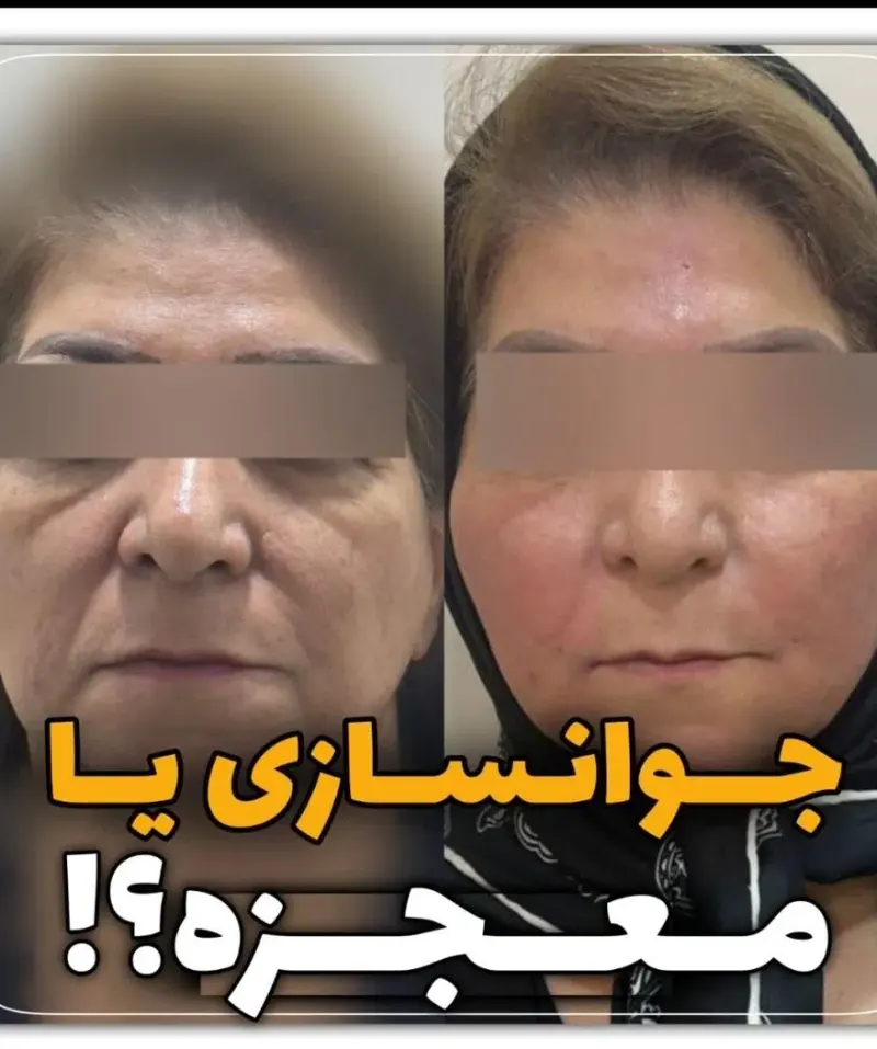 کلینیک زیبایی و لیزر دکتر نعیم کلینی