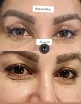 کلینیک زیبایی امیریان شیراز