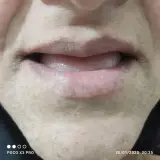 دندانسازی رستمی در نیروگاه قم