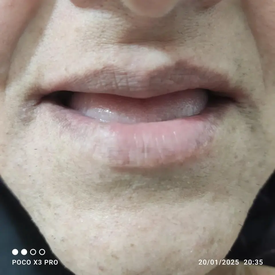 دندانسازی رستمی در نیروگاه قم