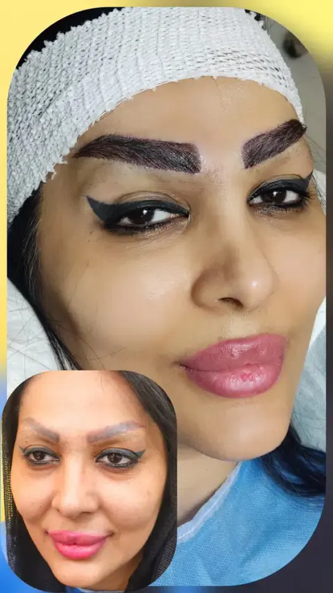 کلینیک کاشت مو مریم شیرزادگان