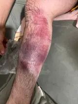 مطب دکتر شیری متخصص ارتوپیدی