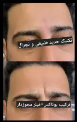 کلینیک لیزر و پوست دکتر فروغ نجفی